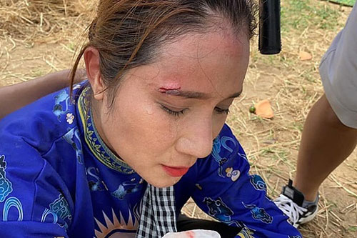 Cát Tường phải khâu 3 mũi do tai nạn phim trường