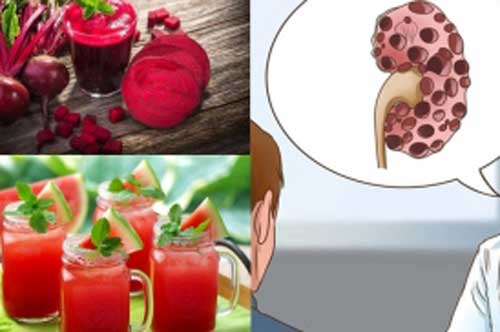 3 thức uống "thần kỳ" giúp bạn "hồi sinh" thận chỉ sau 2 ngày