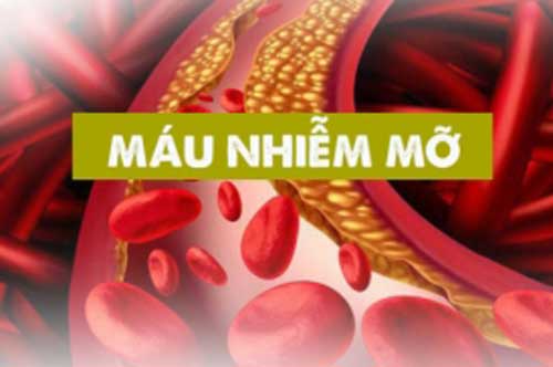 Những dấu hiệu cảnh báo máu nhiễm mỡ, chớ dại chủ quan