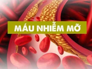 Những dấu hiệu cảnh báo máu nhiễm mỡ, chớ dại chủ quan