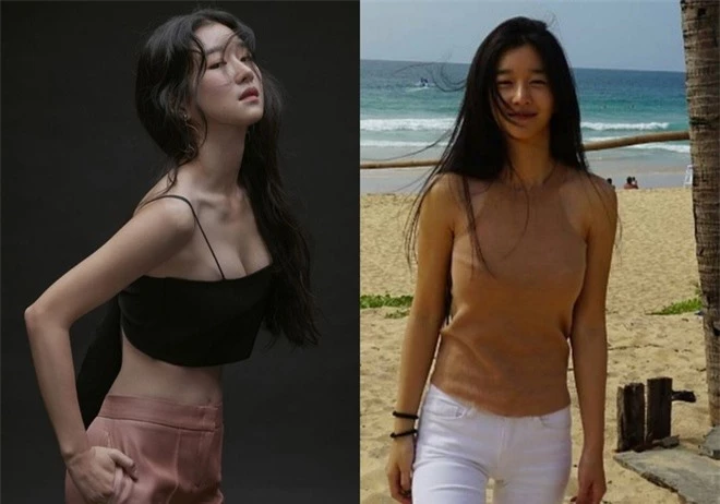 Vì sao điên nữ của Kim Soo Hyun không dám mặc bikini? - Ảnh 2
