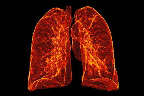 Dùng máu lợn nuôi phổi người để phục vụ cấy ghép