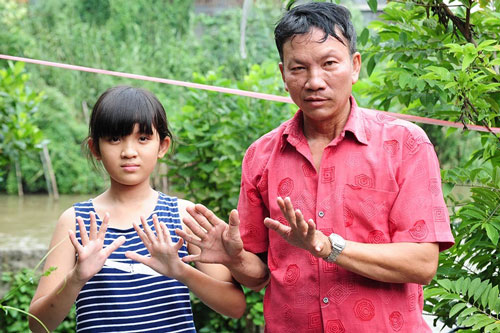 Gia đình 3 thế hệ có 24 ngón tay, chân ở miền Tây