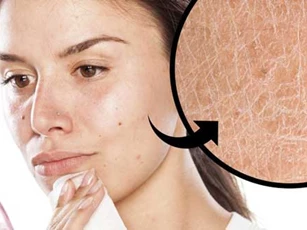 Dùng khăn ướt tẩy trang: Thói quen nhiều người mắc gây hại làn da, thậm chí có thể mắc ung thư