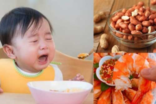 Điểm danh 5 thực phẩm dễ gây dị ứng cho trẻ, mẹ lưu ý khi cho con ăn dặm