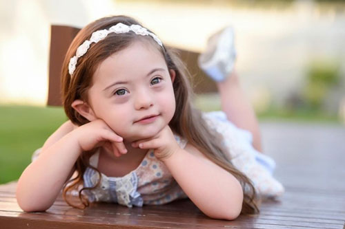 Cô bé mắc hội chứng Down trở thành mẫu nhí