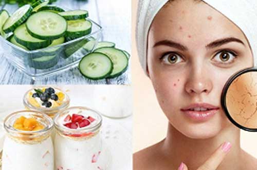 Thời tiết hanh khô, ăn ngay những thực phẩm mọng nước bổ sung độ ẩm cho da này