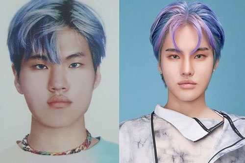 Rapper Hàn đăng ảnh băng bó mặt, thừa nhận 'dao kéo' vì bị miệt thị