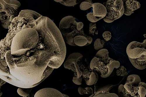 Phát hiện vi khuẩn ăn kim loại