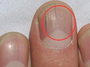 Phát hiện cơ thể có những dấu hiệu này, hãy đi khám gan ngay kẻo ung thư 'ghé thăm', hối không kịp