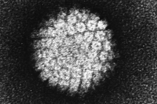 Virus HPV có thể gây ung thư tuyến tiền liệt