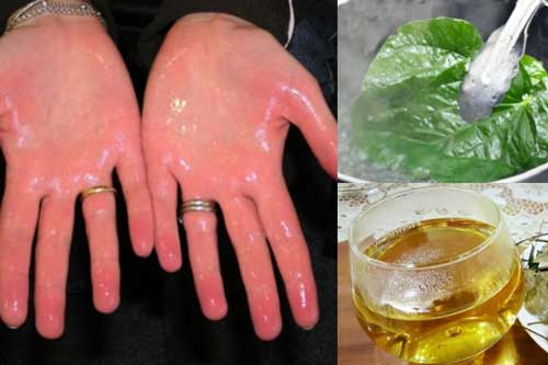 Làm theo cách này bất kể mồ hôi tay chân lâu năm đến đâu cũng khỏi