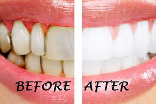 Nhai thứ này mỗi sáng, răng trắng bóng như sứ và hết hẳn hôi miệng sau vài ngày