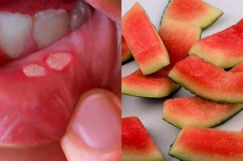 Ăn dưa hấu đừng vội vứt vỏ đi: Giữ lại làm theo cách này sẽ thấy điều kỳ diệu, cực tốt cho sức khỏe