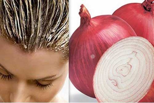 Mẹo hay: "Tạm biệt" tóc rụng, hói đầu chỉ bằng 1 củ hành tây
