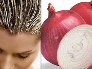Mẹo hay: "Tạm biệt" tóc rụng, hói đầu chỉ bằng 1 củ hành tây