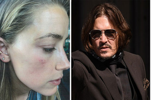 Amber Heard: 'Johnny Depp ném 30 chai lọ vào tôi như lựu đạn'
