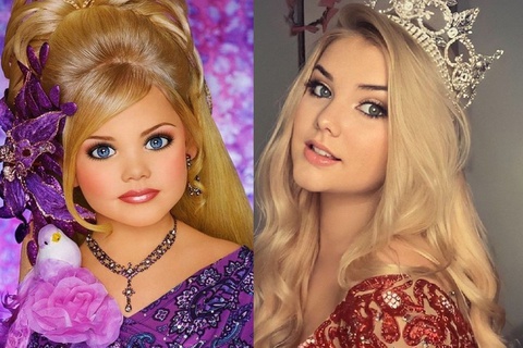 Tuổi thơ 'chín ép', phải tiêm botox vào mặt từ 4 tuổi của hoa hậu nhí
