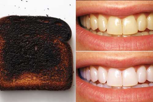 Nướng cháy bánh mì rồi chà lên răng 2 phút, răng trắng, cao răng bong ra từng mảng