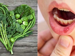 Bị nhiệt miệng, ăn ngay 5 loại thực phẩm này để nhanh khỏi