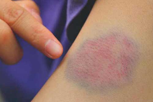 Ngủ dậy vào buổi sáng nếu nhận thấy có 5 dấu hiệu bất thường, đừng chủ quan với căn bệnh nguy hiểm