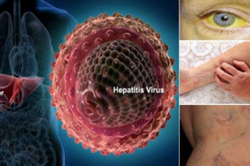 Dấu hiệu "2 ngứa 1 đen" trên cơ thể cảnh báo căn bệnh nguy hiểm, hãy đi khám ngay