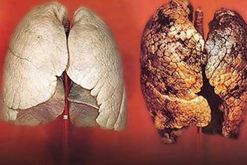 Đây chính là loại quả ăn vào lọc sạch phổi cho người hút thuốc lá, ai cũng nên biết để tự cứu mình