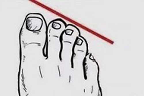 Trắc nghiệm: Dự đoán mức độ giàu có của bạn qua tướng bàn chân