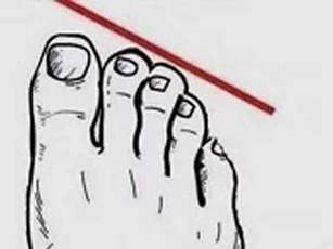 Trắc nghiệm: Dự đoán mức độ giàu có của bạn qua tướng bàn chân