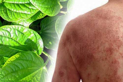 Ai hay bị viêm da cơ địa hãy đun sôi nước lá lốt và tắm, điều kỳ diệu sẽ xảy ra