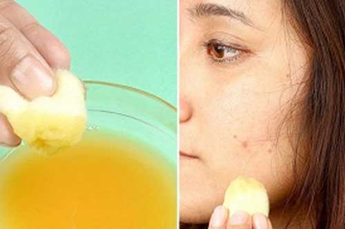 Dùng chanh theo cách này mỗi tối, da đẹp mịn màng hết thâm nám 'hút hồn' người đối diện