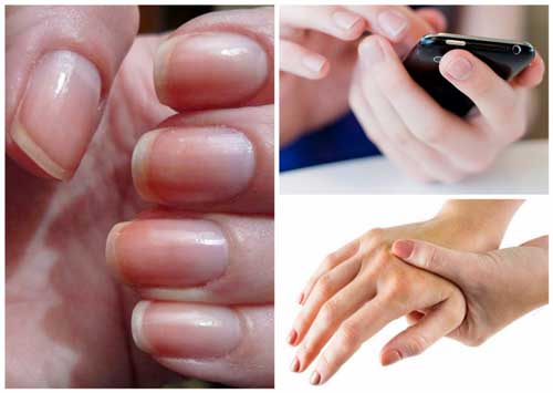 Nhìn vào ngón tay thấy có dấu hiệu này hãy nghĩ ngay tới căn bệnh nguy hiểm, đề phòng không thừa