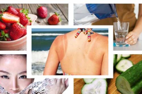 Làn da bị cháy nắng nhìn bong tróc, đừng lo lắng mà hãy làm ngay những mẹo nhỏ dưới đây