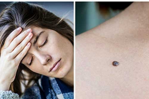 5 dấu hiệu phát hiện ung thư sớm, bạn cần đi khám gấp, nhất là điều thứ 2