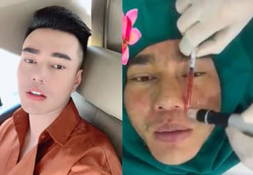 Lê Dương Bảo Lâm thừa nhận độn cằm, sửa mũi, cắt mí: 'Tôi cũng nghiện thẩm mỹ luôn rồi, chỉ sau chị Lê Giang'