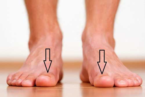 Bàn chân xuất hiện cùng lúc 3 dấu hiệu này: Cảnh báo thận đang "kêu cứu" gấp, hãy đi kiểm tra ngay