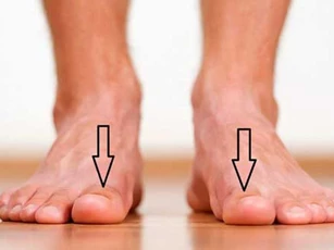 Bàn chân xuất hiện cùng lúc 3 dấu hiệu này: Cảnh báo thận đang "kêu cứu" gấp, hãy đi kiểm tra ngay