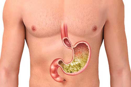 5 loại thực phẩm "cấm" ăn khi bụng đói kẻo tự tay "phá nát" dạ dày