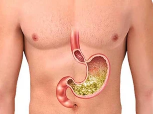 5 loại thực phẩm "cấm" ăn khi bụng đói kẻo tự tay "phá nát" dạ dày