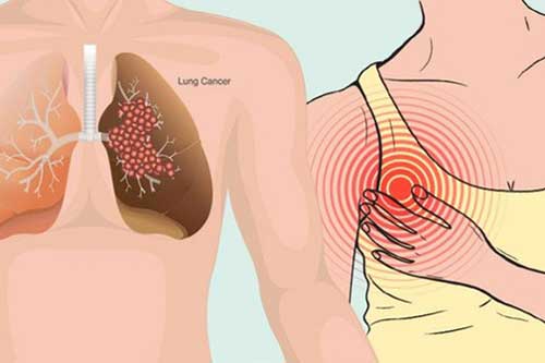 Buổi sáng thức dậy thấy có dấu hiệu này: Hãy tới gặp bác sĩ ngay lập tức kẻo ung thư đang tấn công