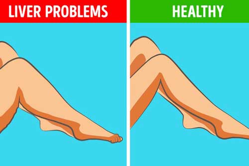 Nhìn xuống bàn chân: Thấy dấu hiệu này là cảnh báo nội tạng đang gặp nguy hiểm, hãy cảnh giác!