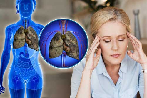 Tín hiệu cảnh báo ung thư phổi đang tấn công cơ thể, chớ dại mà coi thường