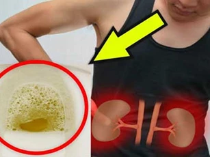 Thấy nước tiểu chuyển sang màu này, hãy cẩn thận vì căn bệnh nguy hiểm đang "gõ cửa"