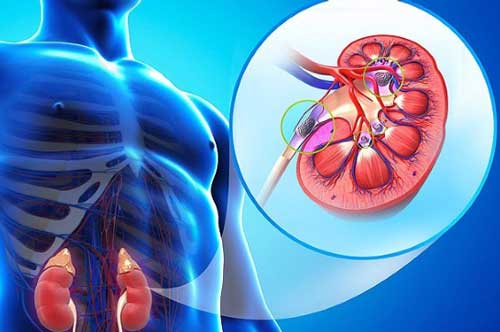 5 thói quen vô tình "rước" sỏi thận về người, rất nhiều người Việt mắc phải mà không biết