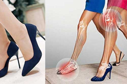 Chị em thường xuyên đi giày cao gót nhưng chủ quan trước tác hại nguy hiểm dưới đây, đọc xong ai cũng rùng mình