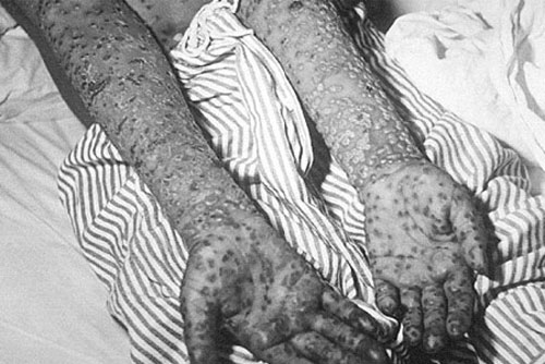 V&#x169; kh&#xED; sinh h&#x1ECD;c - th&#x1EE9; &#x111;&#xE1;ng s&#x1EE3; nh&#x1EA5;t trong l&#x1ECB;ch s&#x1EED; lo&#xE0;i ng&#x1B0;&#x1EDD;i