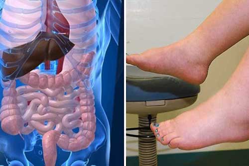 Biểu hiện nội tạng của bạn "nhiễm bẩn" nghiêm trọng cần thải độc gấp