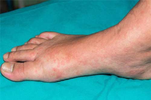 10 thay đổi trên da ''tố cáo'' bạn đang mắc bệnh, càng để lâu càng dễ nguy hiểm đến tính mạng