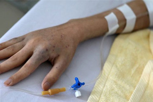 9 dấu hiệu cảnh báo bạn bị ung thư