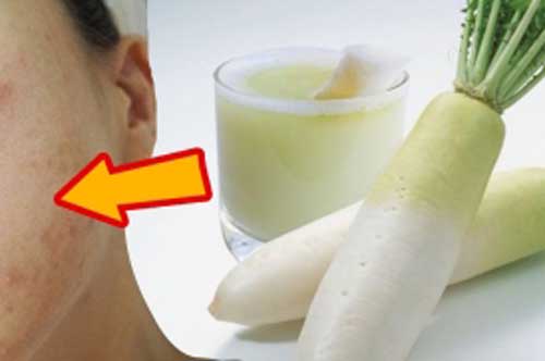 Củ cải không chỉ để nấu các món ngon mà còn có tác dụng chữa bệnh thần kỳ, có thể bạn chưa biết